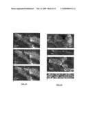 ROBUST MOSAICING METHOD. NOTABLY WITH CORRECTION OF MOTION DISTORTIONS AND TISSUE DEFORMATIONS FOR A VIVO FIBERED MICROSCOPY diagram and image