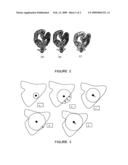 METHOD AND APPARATUS FOR FAST AUTOMATIC CENTERLINE EXTRACTION FOR VIRTUAL ENDOSCOPY diagram and image