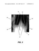 METHOD FOR DETECTING CLIPPED ANATOMY IN MEDICAL IMAGES diagram and image