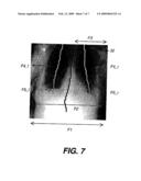 METHOD FOR DETECTING CLIPPED ANATOMY IN MEDICAL IMAGES diagram and image