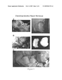 Joint Repair Using Mesenchymal Stem Cells diagram and image