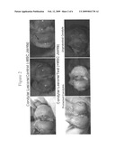 Joint Repair Using Mesenchymal Stem Cells diagram and image