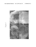 Joint Repair Using Mesenchymal Stem Cells diagram and image