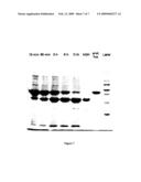 NUCLEIC ACIDS ENCODING RECOMBINANT SOLUBLE ENDOPROTEASES diagram and image