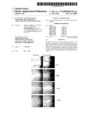 Diagnostic and therapeutic strategies for conditions associated with the FLJ13639 gene diagram and image