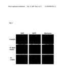 Diagnostic and therapeutic strategies for conditions associated with the FLJ13639 gene diagram and image