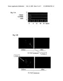 Diagnostic and therapeutic strategies for conditions associated with the FLJ13639 gene diagram and image