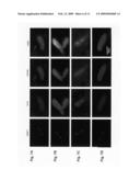 Phosphorylation of 5-lipoxygenase at ser523 and uses thereof diagram and image