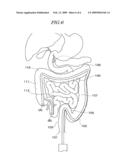 SELF-PROPELLED COLONOSCOPE diagram and image