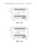 SIGNAL PROCESSING FOR CONTINUOUS ANALYTE SENSOR diagram and image