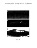 METHOD AND APPARATUS FOR DETERMINATION OF ATHEROSCLEROTIC PLAQUE TYPE BY MEASUREMENT OF TISSUE OPTICAL PROPERTIES diagram and image