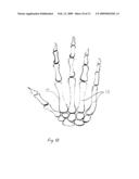IDENTIFICATION OF A PERSON BASED ON ULTRA-SOUND SCAN ANALYSES OF HAND BONE GEOMETRY diagram and image