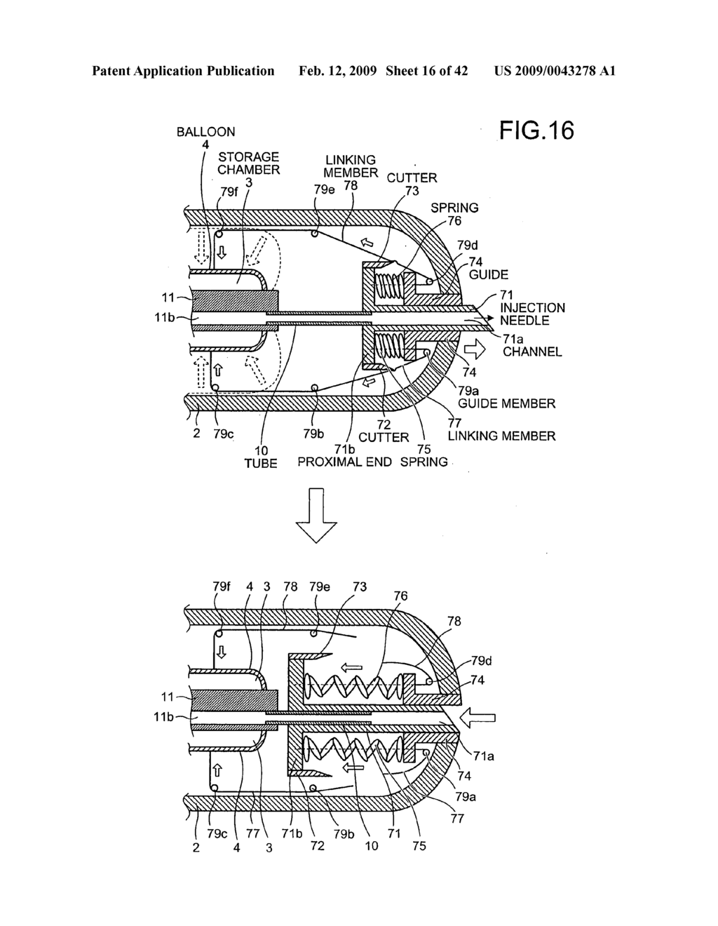 Body-insertable apparatus - diagram, schematic, and image 17