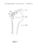 Suture-Retaining Device And Anchor diagram and image