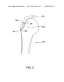 Suture-Retaining Device And Anchor diagram and image