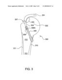 Suture-Retaining Device And Anchor diagram and image