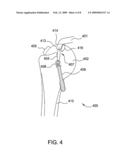 Suture-Retaining Device And Anchor diagram and image
