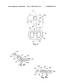 DYNAMIC EXTENSION PLATE FOR ANTERIOR CERVICAL FUSION AND METHOD OF INSTALLATION diagram and image