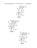 DYNAMIC EXTENSION PLATE FOR ANTERIOR CERVICAL FUSION AND METHOD OF INSTALLATION diagram and image