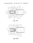 Spinal fusion implants and tools for insertion and revision diagram and image