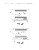 SIGNAL PROCESSING FOR CONTINUOUS ANALYTE SENSOR diagram and image