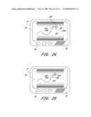 SIGNAL PROCESSING FOR CONTINUOUS ANALYTE SENSOR diagram and image