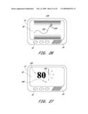 SIGNAL PROCESSING FOR CONTINUOUS ANALYTE SENSOR diagram and image