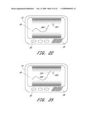 SIGNAL PROCESSING FOR CONTINUOUS ANALYTE SENSOR diagram and image