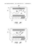 SIGNAL PROCESSING FOR CONTINUOUS ANALYTE SENSOR diagram and image