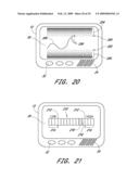 SIGNAL PROCESSING FOR CONTINUOUS ANALYTE SENSOR diagram and image