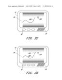 SIGNAL PROCESSING FOR CONTINUOUS ANALYTE SENSOR diagram and image