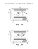 SIGNAL PROCESSING FOR CONTINUOUS ANALYTE SENSOR diagram and image