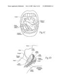 Implantable devices, systems, and methods for maintaining desired orientations in targeted tissue regions diagram and image