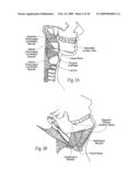 Implantable devices, systems, and methods for maintaining desired orientations in targeted tissue regions diagram and image