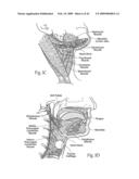 Implantable devices, systems, and methods for maintaining desired orientations in targeted tissue regions diagram and image