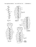 Implantable devices, systems, and methods for maintaining desired orientations in targeted tissue regions diagram and image