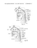 Implantable devices, systems, and methods for maintaining desired orientations in targeted tissue regions diagram and image