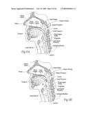 Implantable devices, systems, and methods for maintaining desired orientations in targeted tissue regions diagram and image