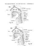 Implantable devices, systems, and methods for maintaining desired orientations in targeted tissue regions diagram and image