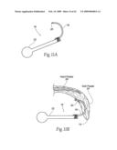 Implantable devices, systems, and methods for maintaining desired orientations in targeted tissue regions diagram and image