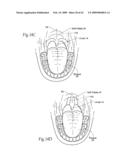 Implantable devices, systems, and methods for maintaining desired orientations in targeted tissue regions diagram and image