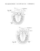 Implantable devices, systems, and methods for maintaining desired orientations in targeted tissue regions diagram and image