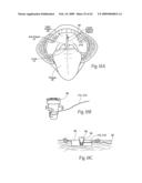 Implantable devices, systems, and methods for maintaining desired orientations in targeted tissue regions diagram and image