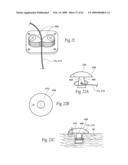 Implantable devices, systems, and methods for maintaining desired orientations in targeted tissue regions diagram and image