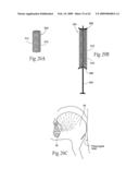 Implantable devices, systems, and methods for maintaining desired orientations in targeted tissue regions diagram and image