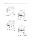 Implantable devices, systems, and methods for maintaining desired orientations in targeted tissue regions diagram and image