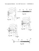 Implantable devices, systems, and methods for maintaining desired orientations in targeted tissue regions diagram and image