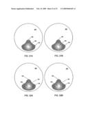 MULTIFOCAL LENS WITH A DIFFRACTIVE OPTICAL POWER REGION diagram and image