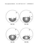 MULTIFOCAL LENS WITH A DIFFRACTIVE OPTICAL POWER REGION diagram and image