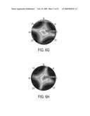 REFLECTIVE PLATE, DISPLAY HAVING THE SAME, AND METHOD OF CONTROLLING DISTRIBUTION OF REFLECTED LIGHT diagram and image